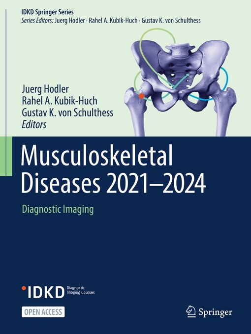 Title details for Musculoskeletal Diseases 2021-2024 by Juerg Hodler - Available